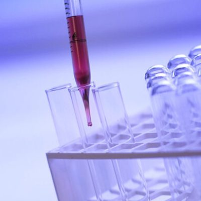 Free scientist running blood test image, public domain CC0 photo